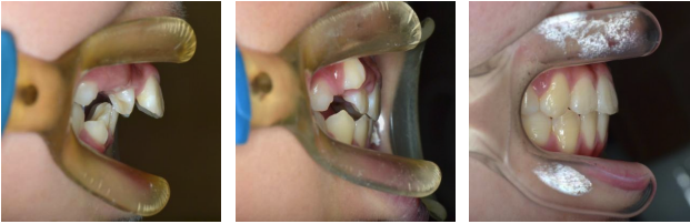 治療前と治療後