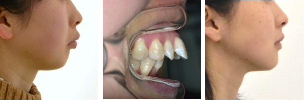 治療前と治療後