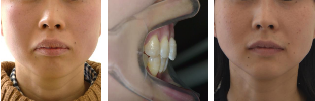 治療前と治療後