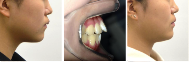 治療前と治療後