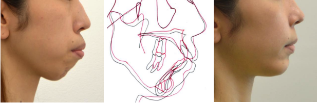 治療前と治療後