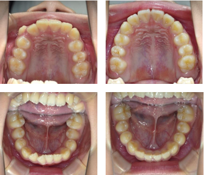 治療前と治療後