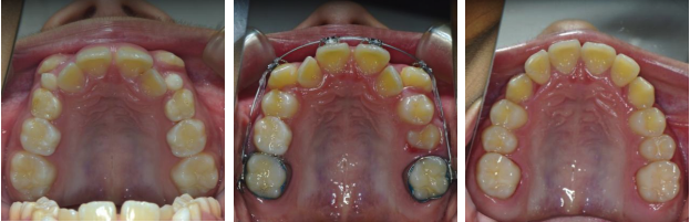 治療前と治療後